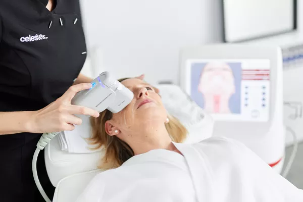 Lifting non chirurgical avec l'HIFU