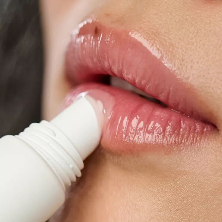 Lip filler - galerie