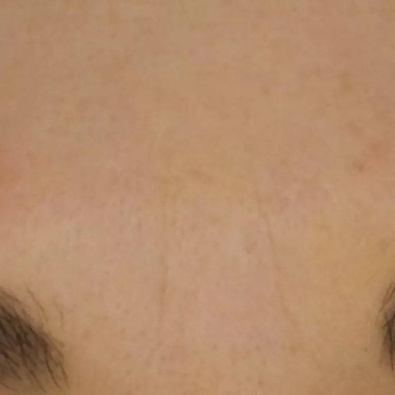 After